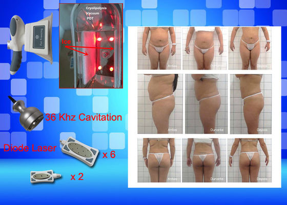 Cryo que congela el peso del equipo del laser Lipo pierde la máquina casera de la belleza