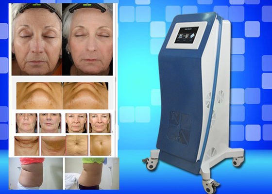 Cryo que congela el peso del equipo del laser Lipo pierde la máquina casera de la belleza
