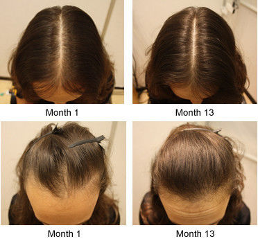 Líquido denso del pelo del resultado del resplandor solar del pelo del crecimiento 6 del shou in1 del pelo adicional real de la explosión